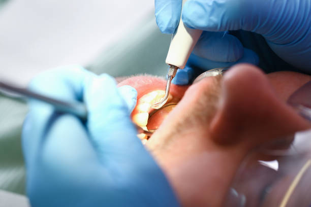 Professional Emergency Dentist in MS