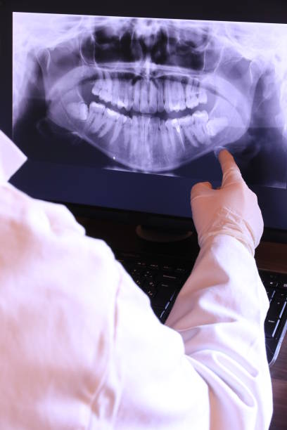 Best Emergency Tooth Extraction in Starkville, MS